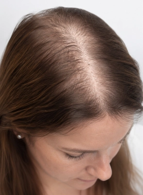 До
